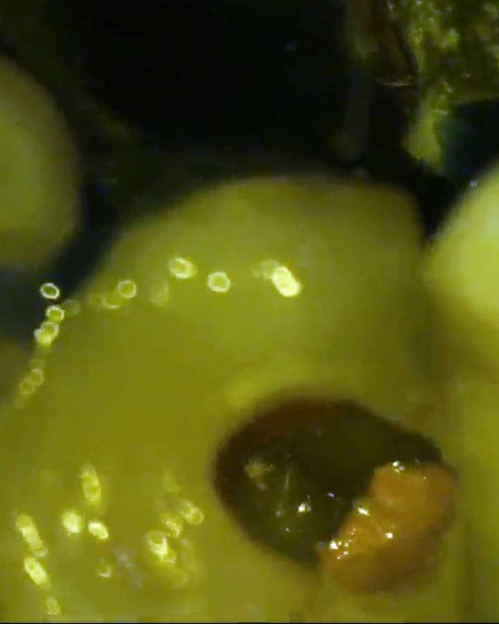 Microscope endodontics — mandibular first molar access and canals