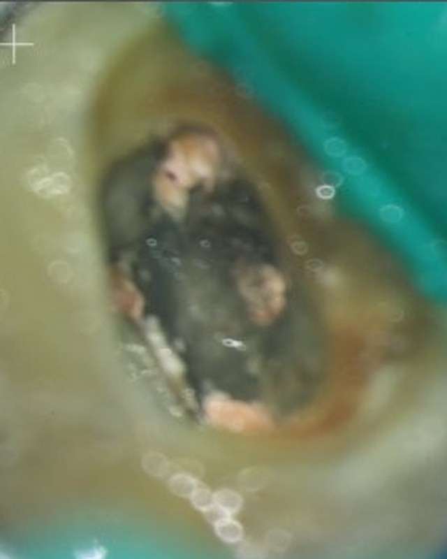 Microscope Endodontics